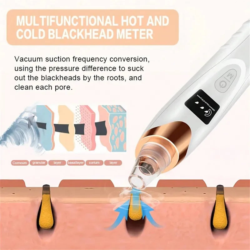 Blackhead Remover Vacuum – Electric Facial Pore Cleanser